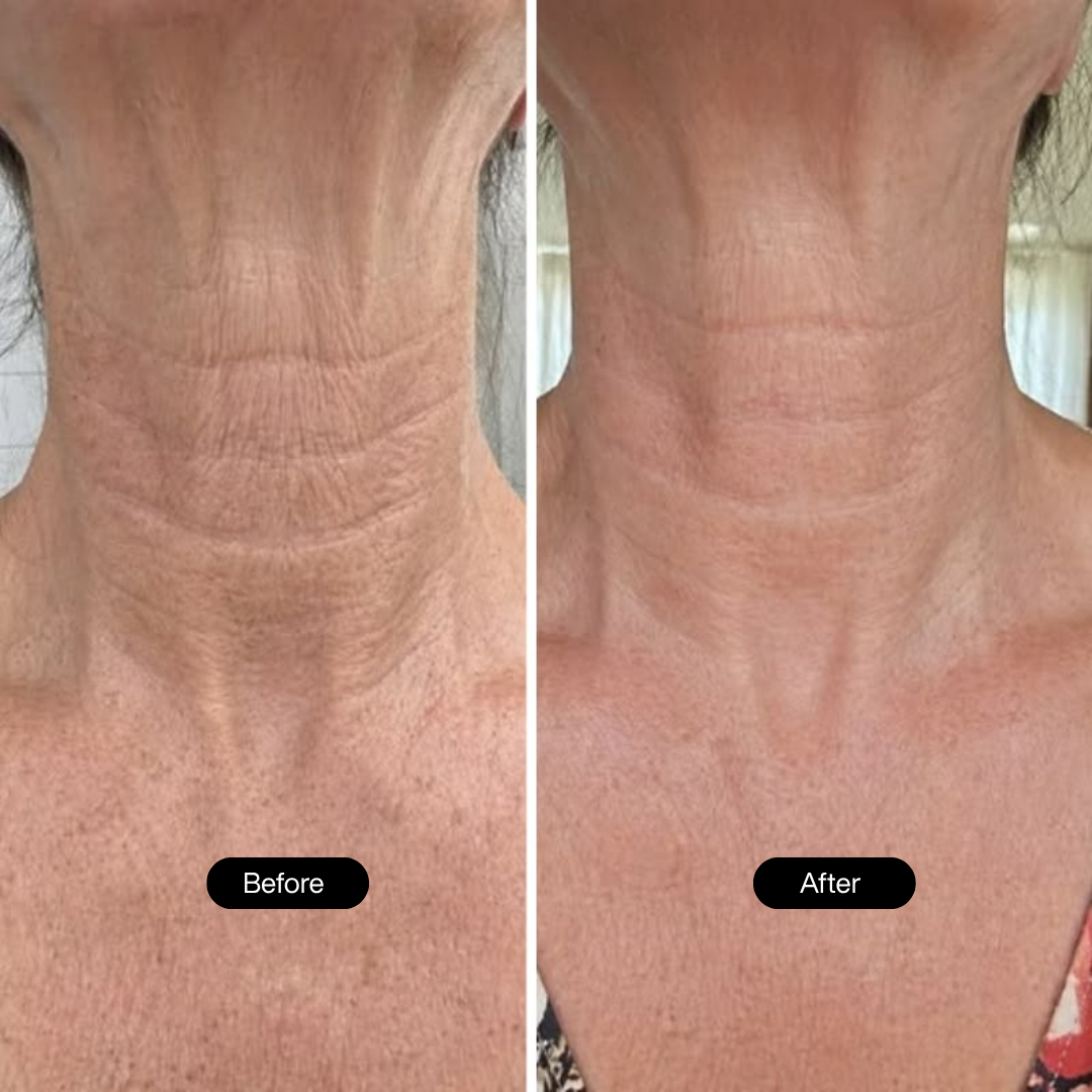 Nederm | Neck Firming Stick