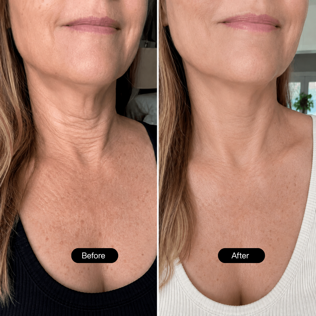 Nederm | Neck Firming Stick